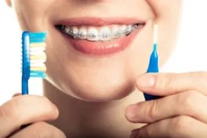 Teeth with braces and toothbrush illustrating proper cleaning techniques.