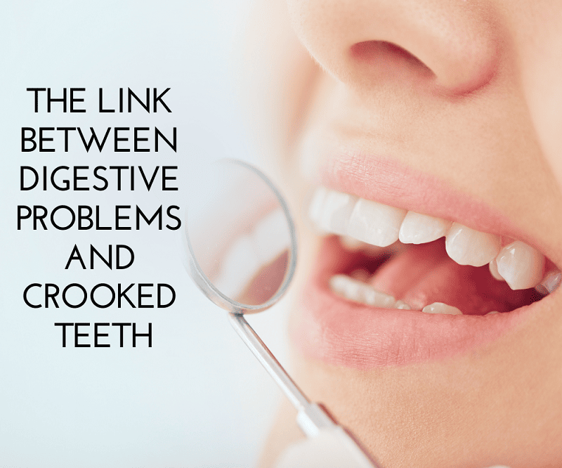 Invisible Braces for Crooked Teeth In Wichita KS