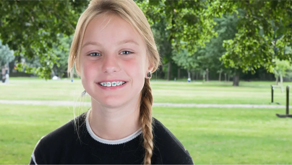 Braces kids smile