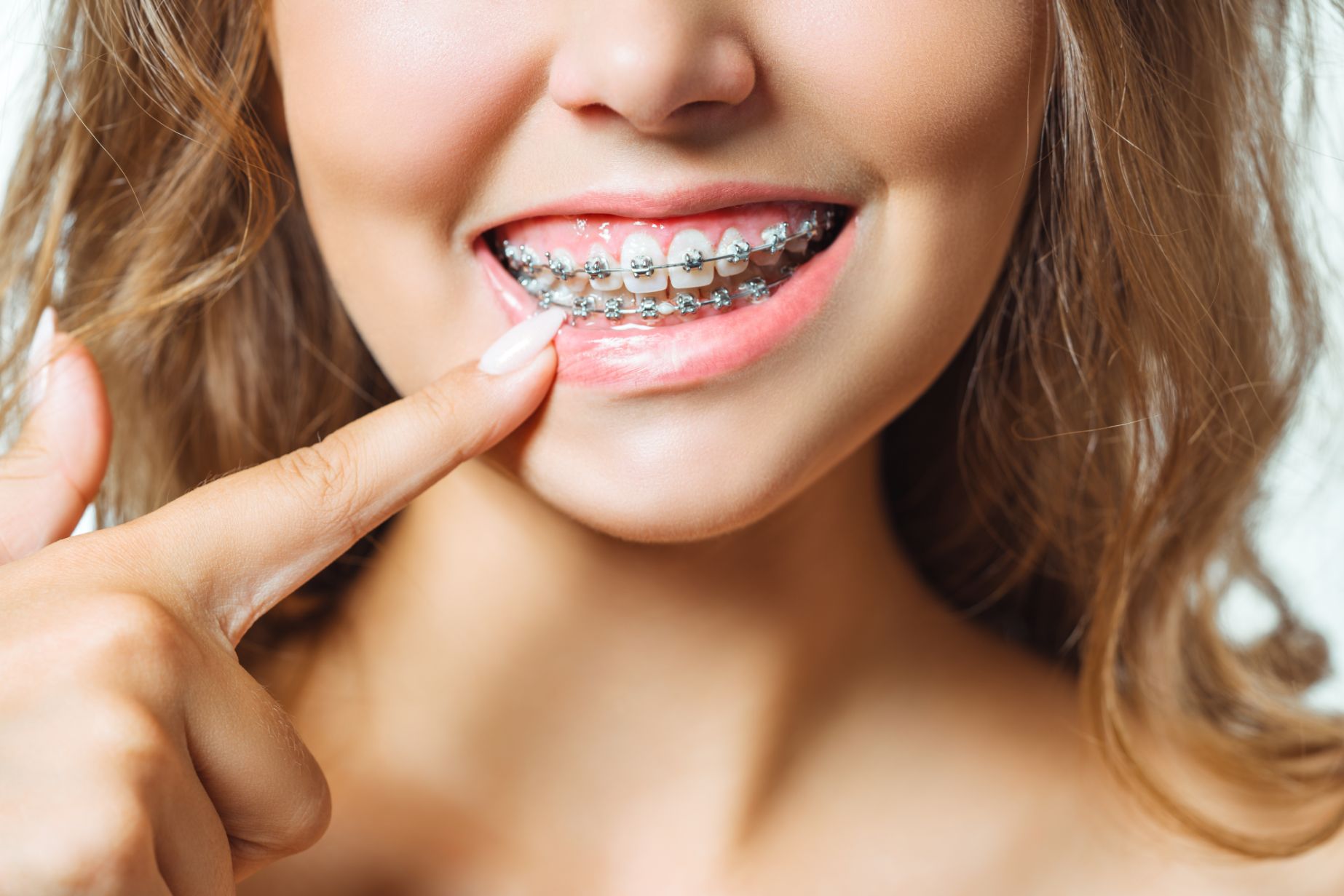 Other Treatments - Hansen Orthodontics